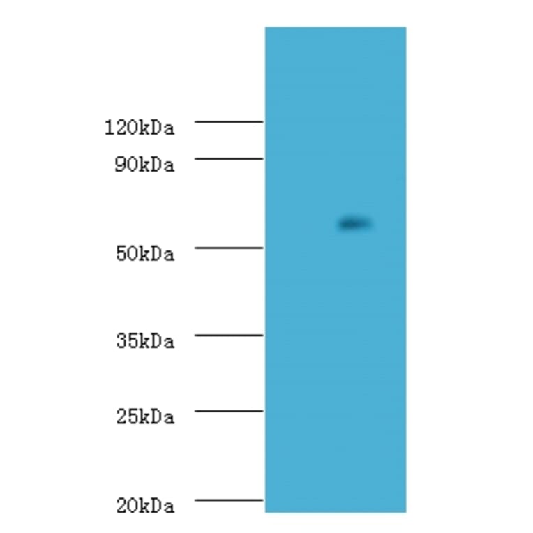 Uncharacterized aarF domain-containing protein kinase 2 Polyclonal Antibody from Signalway Antibody (42660)