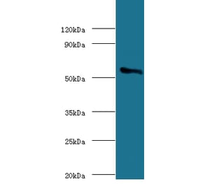 Cholesterol side-chain cleavage enzyme, mitochondrial Polyclonal Antibody from Signalway Antibody (42142)