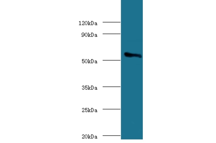 Cholesterol side-chain cleavage enzyme, mitochondrial Polyclonal Antibody from Signalway Antibody (42142)
