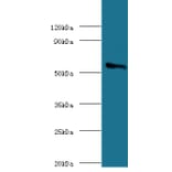 Cholesterol side-chain cleavage enzyme, mitochondrial Polyclonal Antibody from Signalway Antibody (42142)