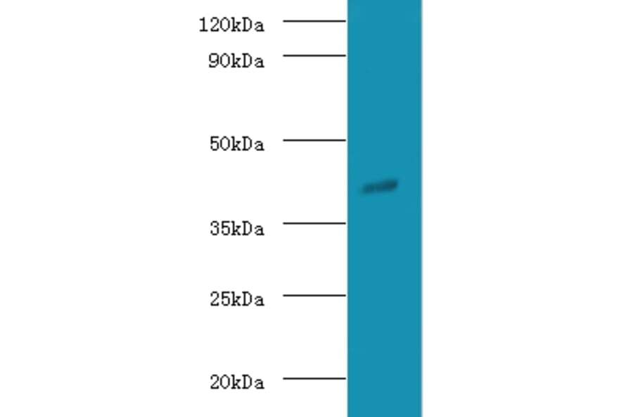 Guanine nucleotide-binding protein G (o) subunit alpha Polyclonal Antibody from Signalway Antibody (42186)