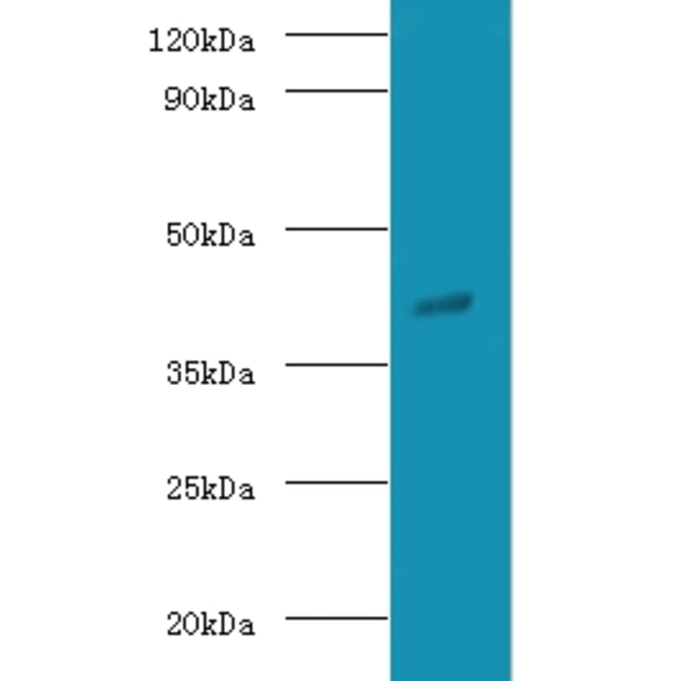Guanine nucleotide-binding protein G (o) subunit alpha Polyclonal Antibody from Signalway Antibody (42186)