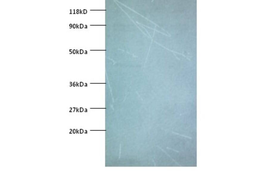 NADH dehydrogenase [ubiquinone] iron-sulfur protein 5 Polyclonal Antibody from Signalway Antibody (42372)