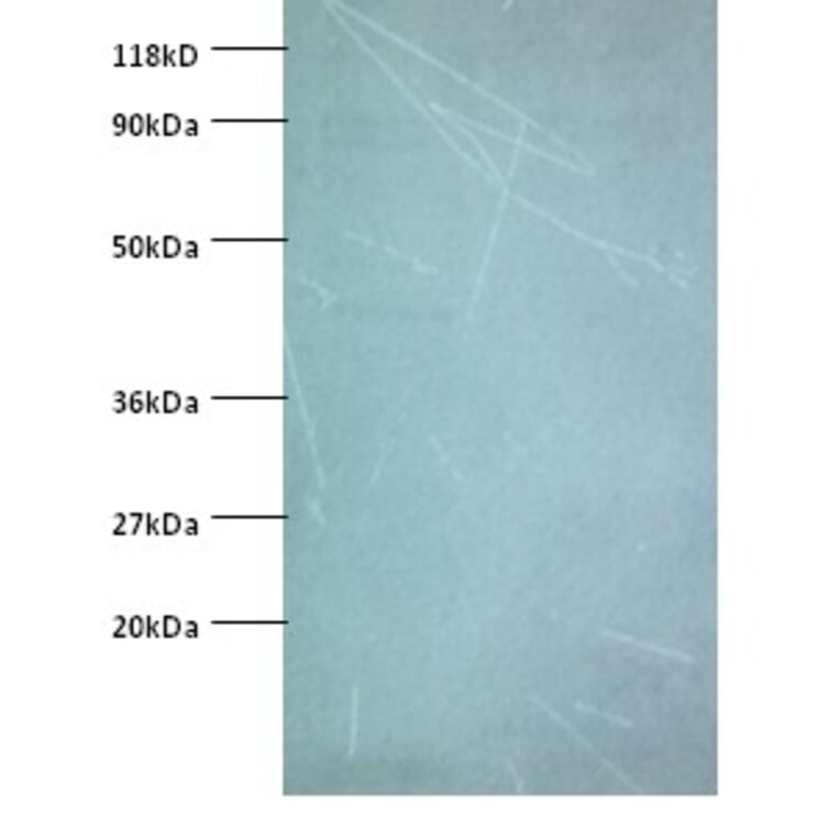 NADH dehydrogenase [ubiquinone] iron-sulfur protein 5 Polyclonal Antibody from Signalway Antibody (42372)