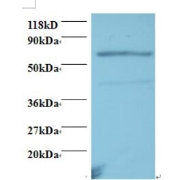 Tumor necrosis factor receptor superfamily member 11A Polyclonal Antibody from Signalway Antibody (42504)