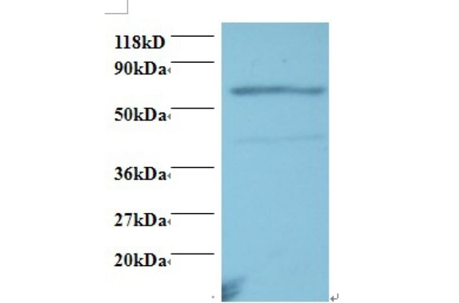 Tumor necrosis factor receptor superfamily member 11A Polyclonal Antibody from Signalway Antibody (42504)