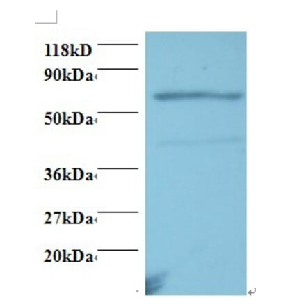 Tumor necrosis factor receptor superfamily member 11A Polyclonal Antibody from Signalway Antibody (42504)