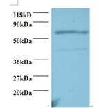 Tumor necrosis factor receptor superfamily member 11A Polyclonal Antibody from Signalway Antibody (42504)