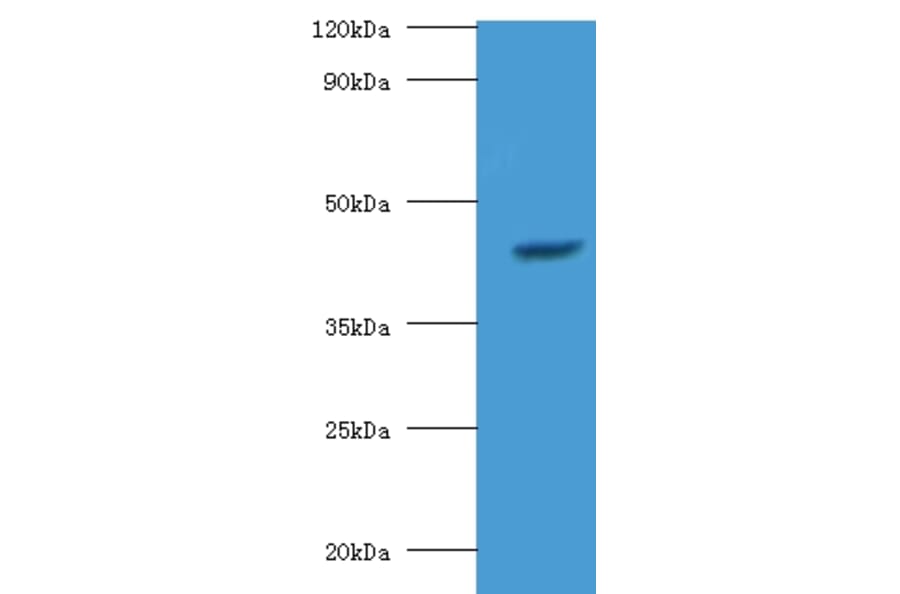 StAR-related lipid transfer protein 7, mitochondrial Polyclonal Antibody from Signalway Antibody - Antibodies.com