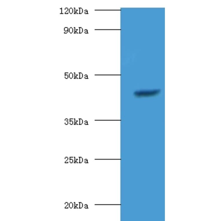 StAR-related lipid transfer protein 7, mitochondrial Polyclonal Antibody from Signalway Antibody - Antibodies.com