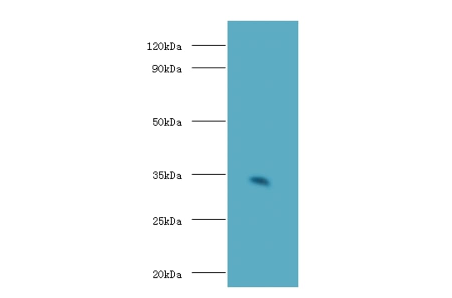 H-2 class II histocompatibility antigen gamma chain Polyclonal Antibody from Signalway Antibody - Antibodies.com