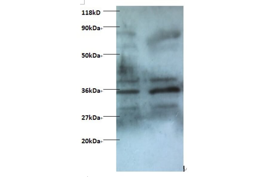 Zinc finger BED domain-containing protein 1 protein Polyclonal Antibody from Signalway Antibody - Antibodies.com