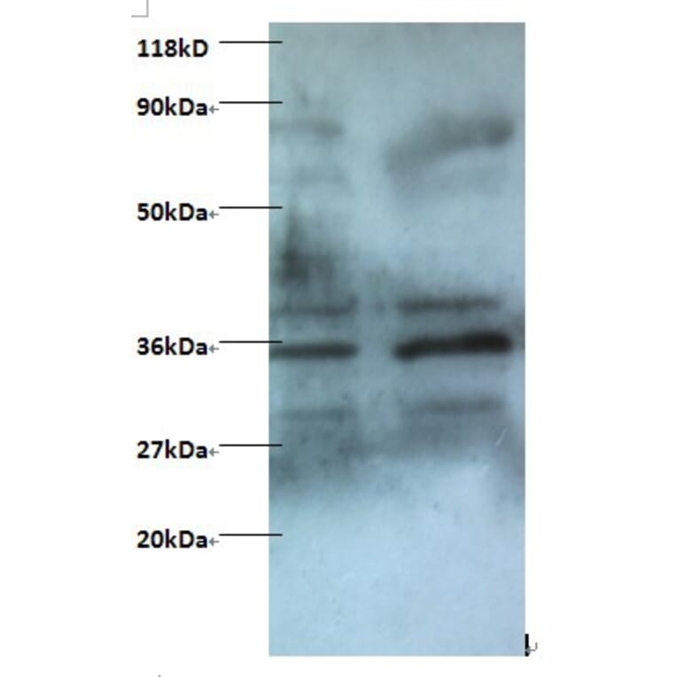 Zinc finger BED domain-containing protein 1 protein Polyclonal Antibody from Signalway Antibody - Antibodies.com