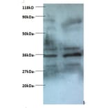 Zinc finger BED domain-containing protein 1 protein Polyclonal Antibody from Signalway Antibody - Antibodies.com