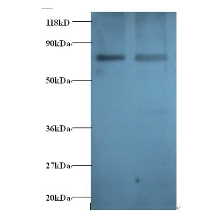 Gamma-aminobutyric acid receptor-associated protein Polyclonal Antibody from Signalway Antibody - Antibodies.com