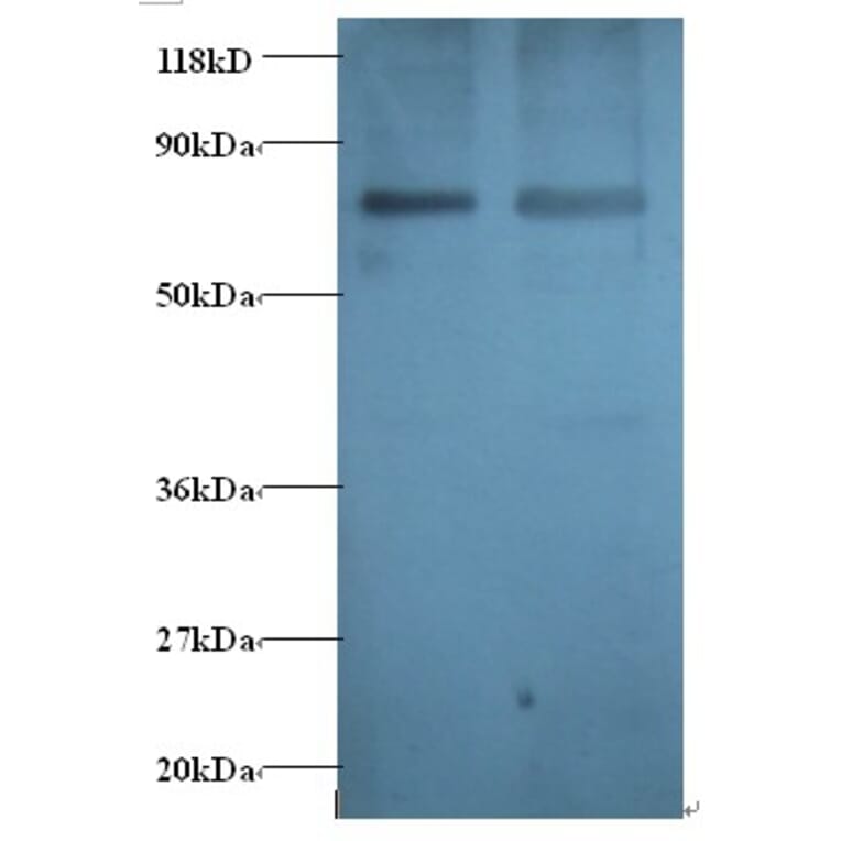 Gamma-aminobutyric acid receptor-associated protein Polyclonal Antibody from Signalway Antibody - Antibodies.com