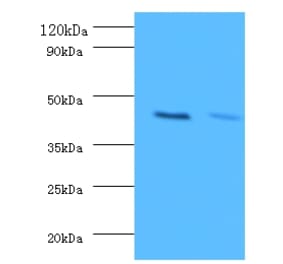 Western blot - ATP-sensitive inward rectifier potassium channel 1 Polyclonal Antibody from Signalway Antibody (42228)