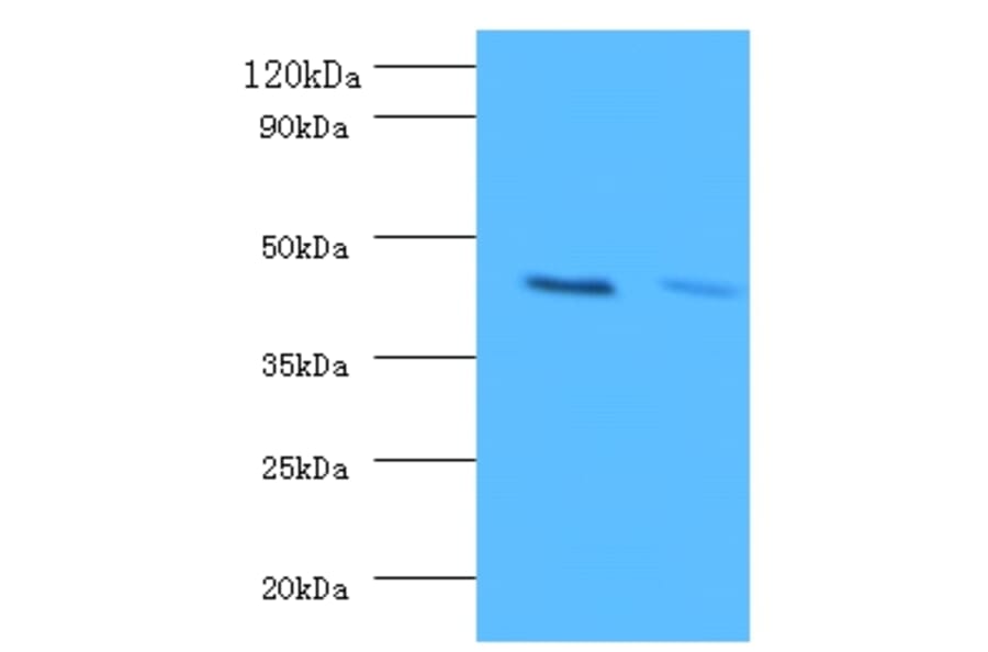 Western blot - ATP-sensitive inward rectifier potassium channel 1 Polyclonal Antibody from Signalway Antibody (42228)