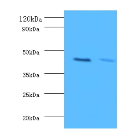 Western blot - ATP-sensitive inward rectifier potassium channel 1 Polyclonal Antibody from Signalway Antibody (42228)
