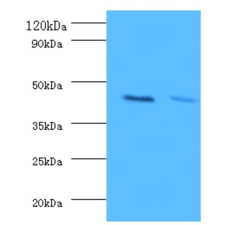 Western blot - ATP-sensitive inward rectifier potassium channel 1 Polyclonal Antibody from Signalway Antibody (42228)