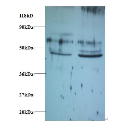 Tumor necrosis factor ligand superfamily member 14 Polyclonal Antibody from Signalway Antibody - Antibodies.com