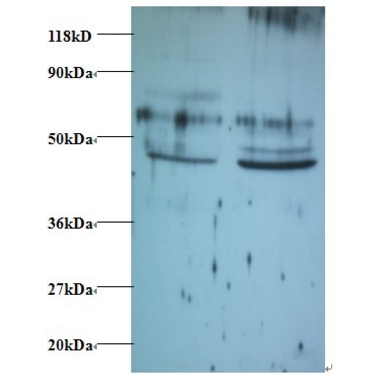 Tumor necrosis factor ligand superfamily member 14 Polyclonal Antibody from Signalway Antibody - Antibodies.com