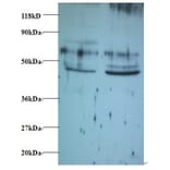 Tumor necrosis factor ligand superfamily member 14 Polyclonal Antibody from Signalway Antibody - Antibodies.com