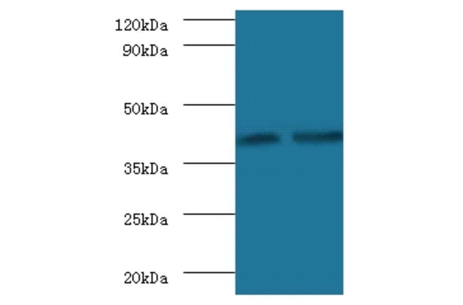 Glycosyltransferase 8 domain-containing protein 2 Polyclonal Antibody from Signalway Antibody - Antibodies.com