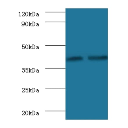 Glycosyltransferase 8 domain-containing protein 2 Polyclonal Antibody from Signalway Antibody - Antibodies.com