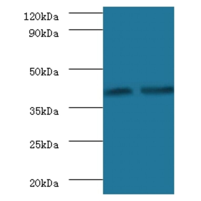 Glycosyltransferase 8 domain-containing protein 2 Polyclonal Antibody from Signalway Antibody - Antibodies.com