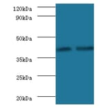 Glycosyltransferase 8 domain-containing protein 2 Polyclonal Antibody from Signalway Antibody - Antibodies.com