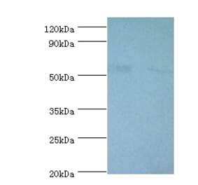 6-phosphogluconate dehydrogenase, decarboxylating Polyclonal Antibody from Signalway Antibody - Antibodies.com