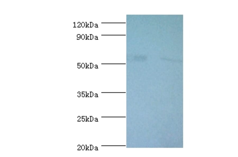 6-phosphogluconate dehydrogenase, decarboxylating Polyclonal Antibody from Signalway Antibody - Antibodies.com