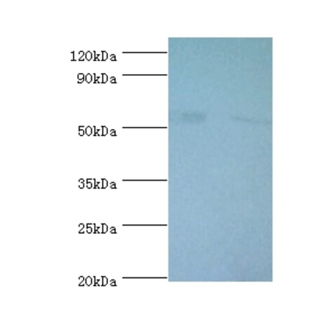6-phosphogluconate dehydrogenase, decarboxylating Polyclonal Antibody from Signalway Antibody - Antibodies.com