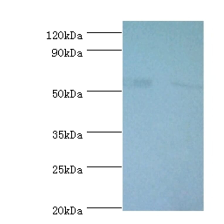 6-phosphogluconate dehydrogenase, decarboxylating Polyclonal Antibody from Signalway Antibody - Antibodies.com