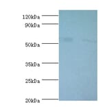 6-phosphogluconate dehydrogenase, decarboxylating Polyclonal Antibody from Signalway Antibody - Antibodies.com