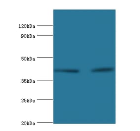 Western blot - Lysosomal acid lipase/cholesteryl ester hydrolase Polyclonal Antibody from Signalway Antibody (42238)