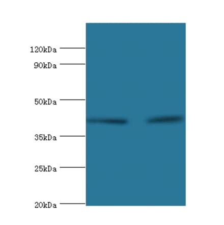 Western blot - Lysosomal acid lipase/cholesteryl ester hydrolase Polyclonal Antibody from Signalway Antibody (42238)