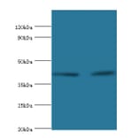 Western blot - Lysosomal acid lipase/cholesteryl ester hydrolase Polyclonal Antibody from Signalway Antibody (42238)