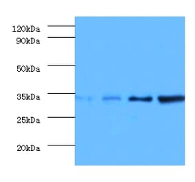 Western blot - Transcription initiation factor IIE subunit beta Polyclonal Antibody from Signalway Antibody (42194)