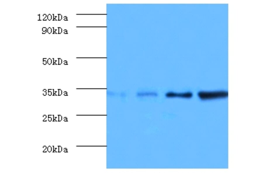 Western blot - Transcription initiation factor IIE subunit beta Polyclonal Antibody from Signalway Antibody (42194)