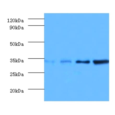 Western blot - Transcription initiation factor IIE subunit beta Polyclonal Antibody from Signalway Antibody (42194)