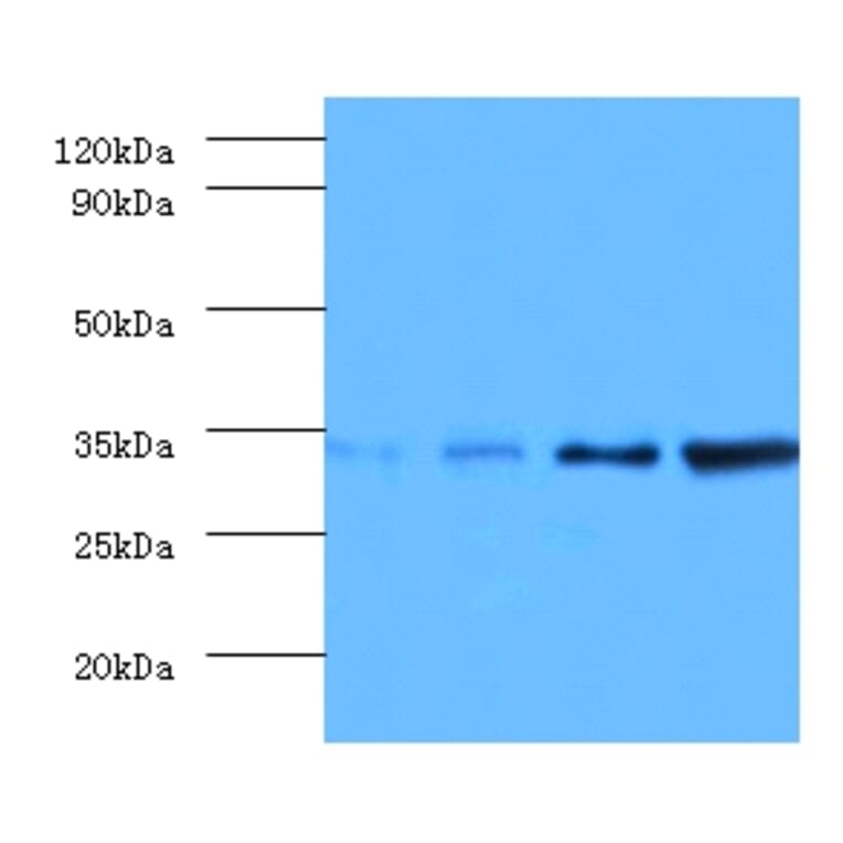 Western blot - Transcription initiation factor IIE subunit beta Polyclonal Antibody from Signalway Antibody (42194)