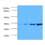 Western blot - Transcription initiation factor IIE subunit beta Polyclonal Antibody from Signalway Antibody (42194)