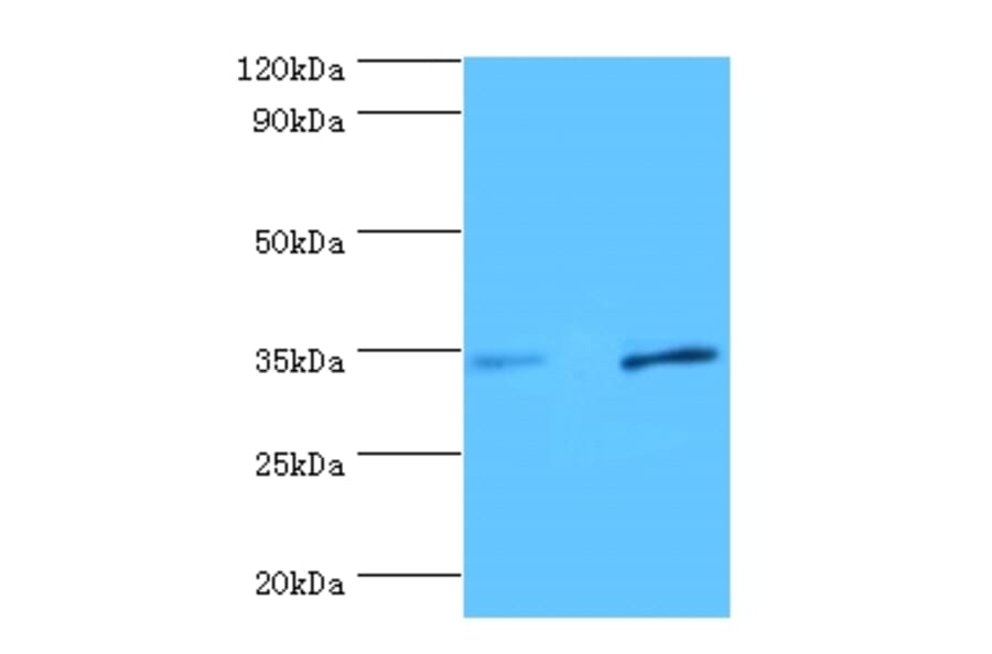 Urokinase plasminogen activator surface receptor Polyclonal Antibody from Signalway Antibody - Antibodies.com