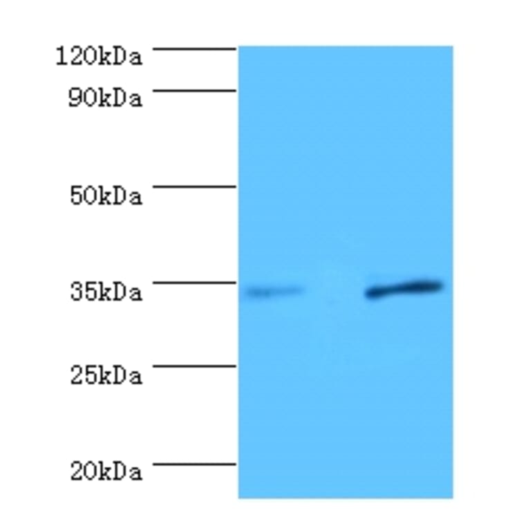 Urokinase plasminogen activator surface receptor Polyclonal Antibody from Signalway Antibody - Antibodies.com