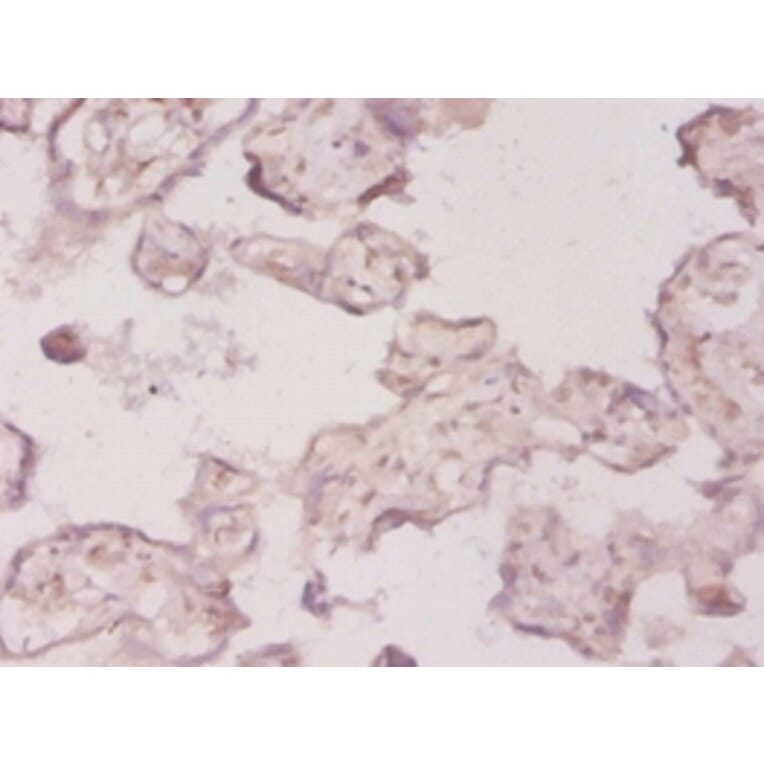 Immunohistochemistry - 3-hydroxy-3 methylglutaryl-coenzyme A reductase Polyclonal Antibody from Signalway Antibody (42206)