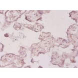 Immunohistochemistry - 3-hydroxy-3 methylglutaryl-coenzyme A reductase Polyclonal Antibody from Signalway Antibody (42206)