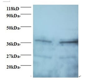 Secretory carrier-associated membrane protein 3 Polyclonal Antibody from Signalway Antibody (42426) - Antibodies.com