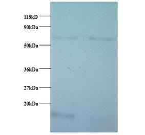 Cytochrome c oxidase subunit 5B, mitochondrial Polyclonal Antibody from Signalway Antibody (42093) - Antibodies.com